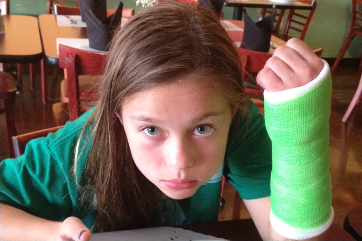 Menina mostrando braço engessado. Imagem ilustrativa texto criança quebrou o braço.
